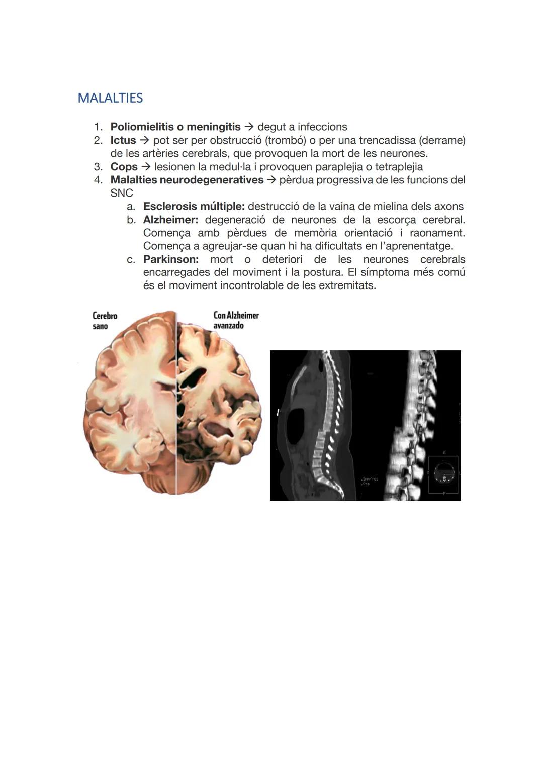 SISTEMA
NERVIÓS I
LES
NEURONES
CAI D 2021-2022 ÍNDEX
INTRODUCCIÓ
ANATOMIA I FISIOLOGIA DEL SISTEMA NERVIÓS.
NEURONES I GLIES.
SINAPSIS.
MIEL