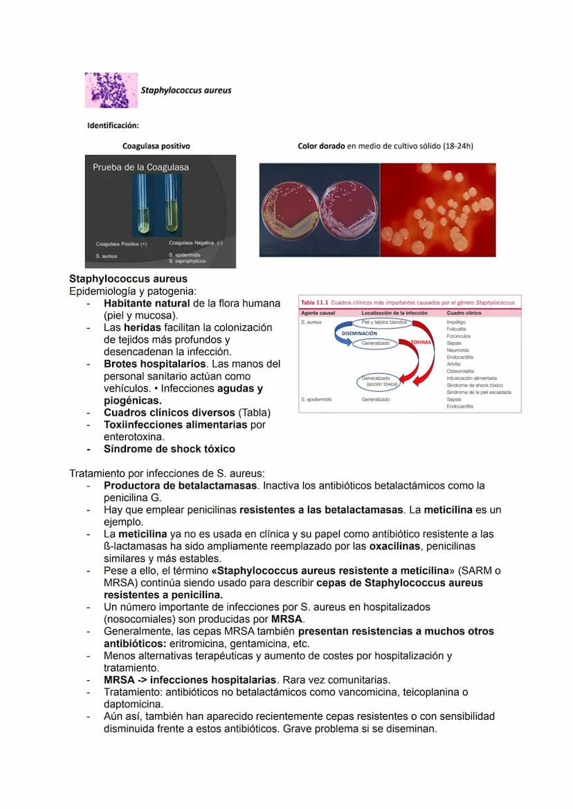 TEMA 14.1: LAS BACTERIAS
Gram positivo
TINCION DE GRAM
Fijación
Cristal violeta
lugol-yodo
Decoloración alcohol -acetona
Coloración de
contr