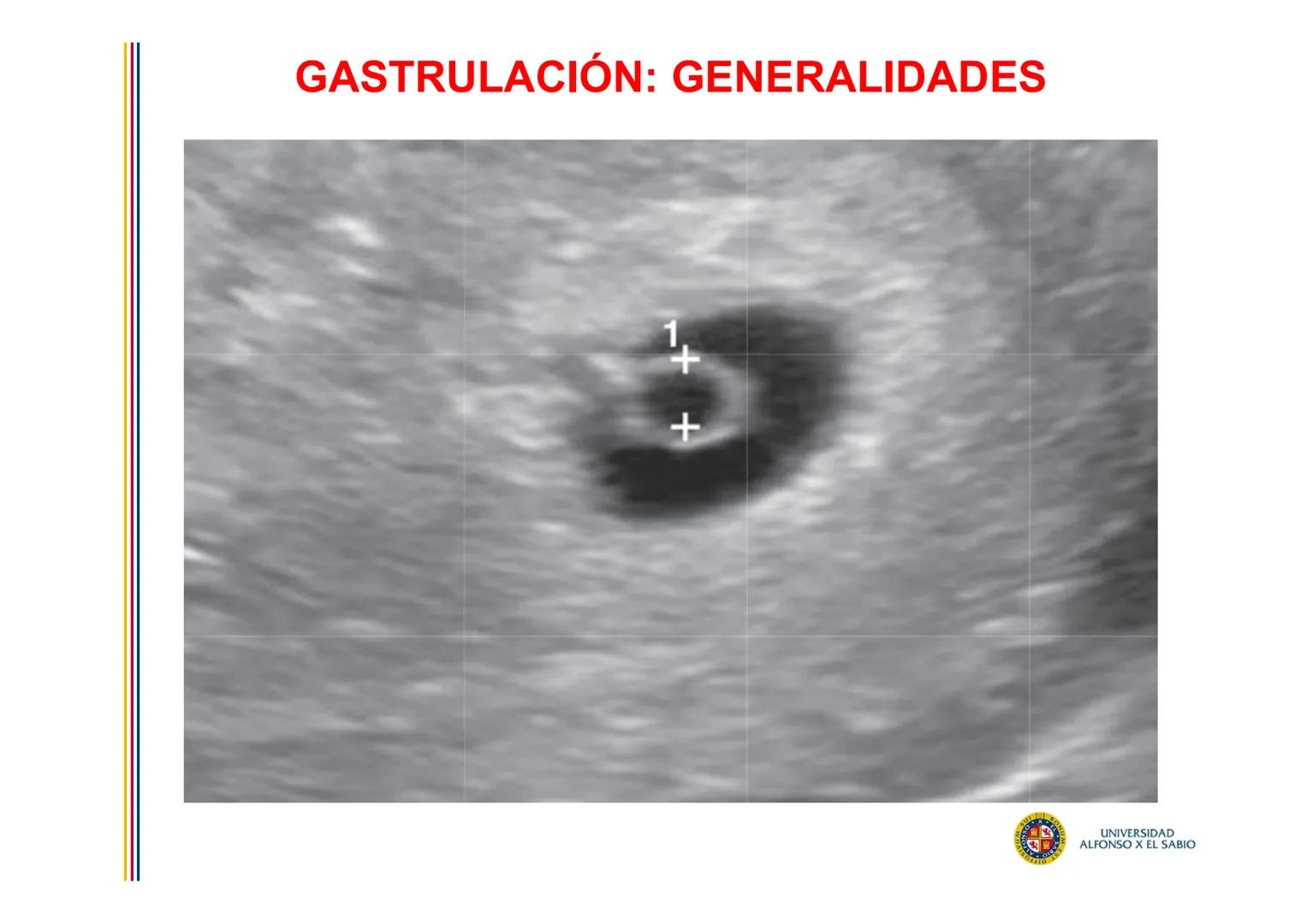 EMBRIOLOGÍA
TEMA 5
TERCERA SEMANA DEL DESARROLLO
FORMACIÓN DEL DISCO
TRILAMINAR
(GASTRULACIÓN)
PROF. DRA. M. ENCARNACIÓN FERNÁNDEZ CONTRERAS