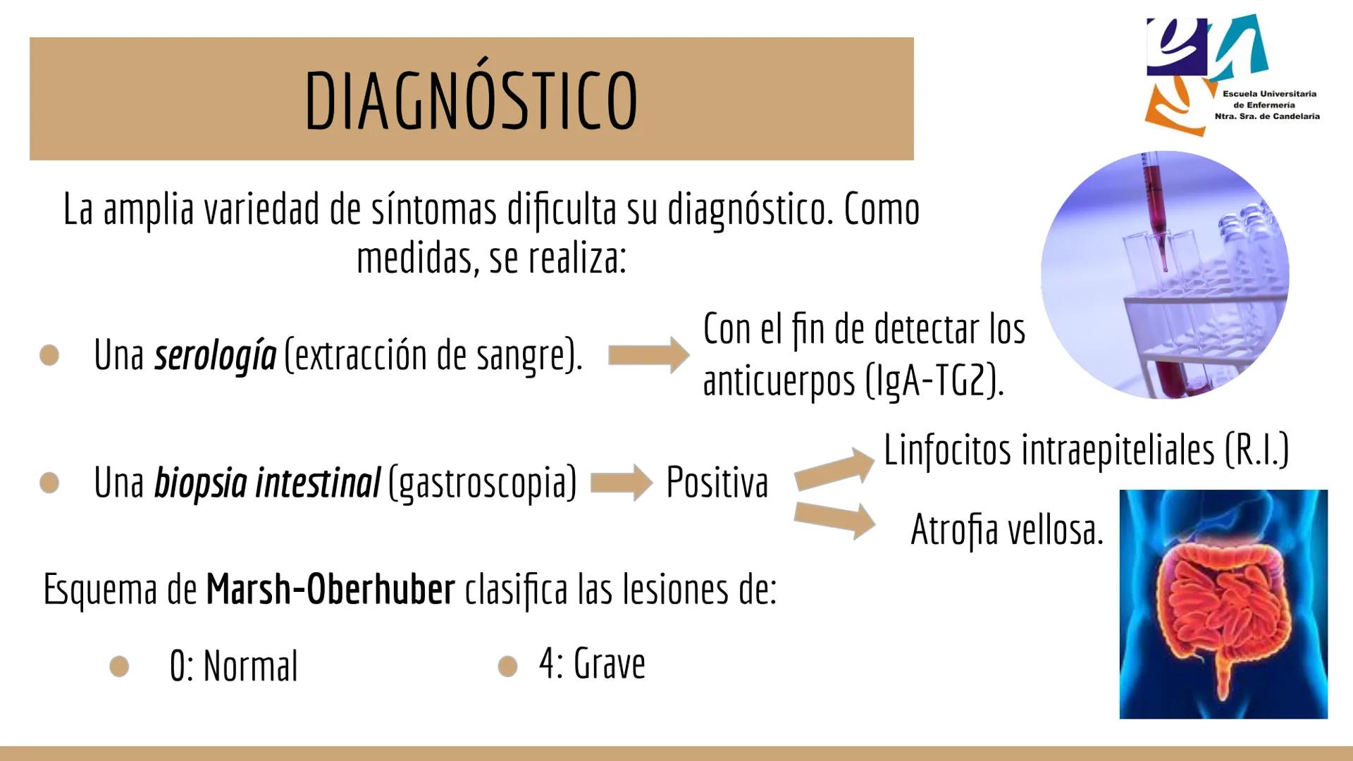 CELIAQUÍA ÍNDICE
1. ¿Qué es la enfermedad celíaca?
2. Diagnóstico de la EC
3. Incidencia
4. Síntomas, factores ambientales y epidemiología
5