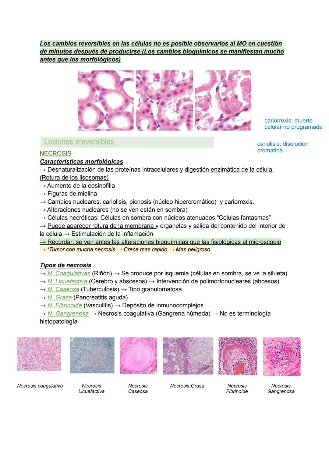 RESPUESTAS CELULARES ANTE EL ESTRÉS Y AGRESIONES EXTERNAS:
ADAPTACIÓN, LESIÓN Y MUERTE CELULAR (I) Y (II). TEMA 1
→ Las células mantienen un