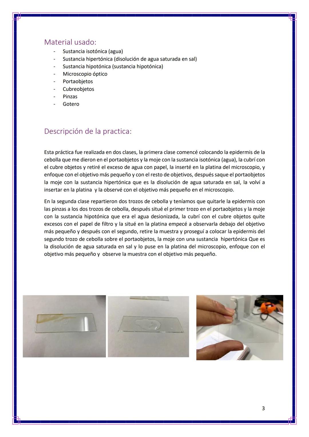 Ampliación de biología
OBJETIVOS:
●
Ósmosis
Informe Nº2
Observar los efectos producidos por la ósmosis en la epidermis de la cebolla.
Visual