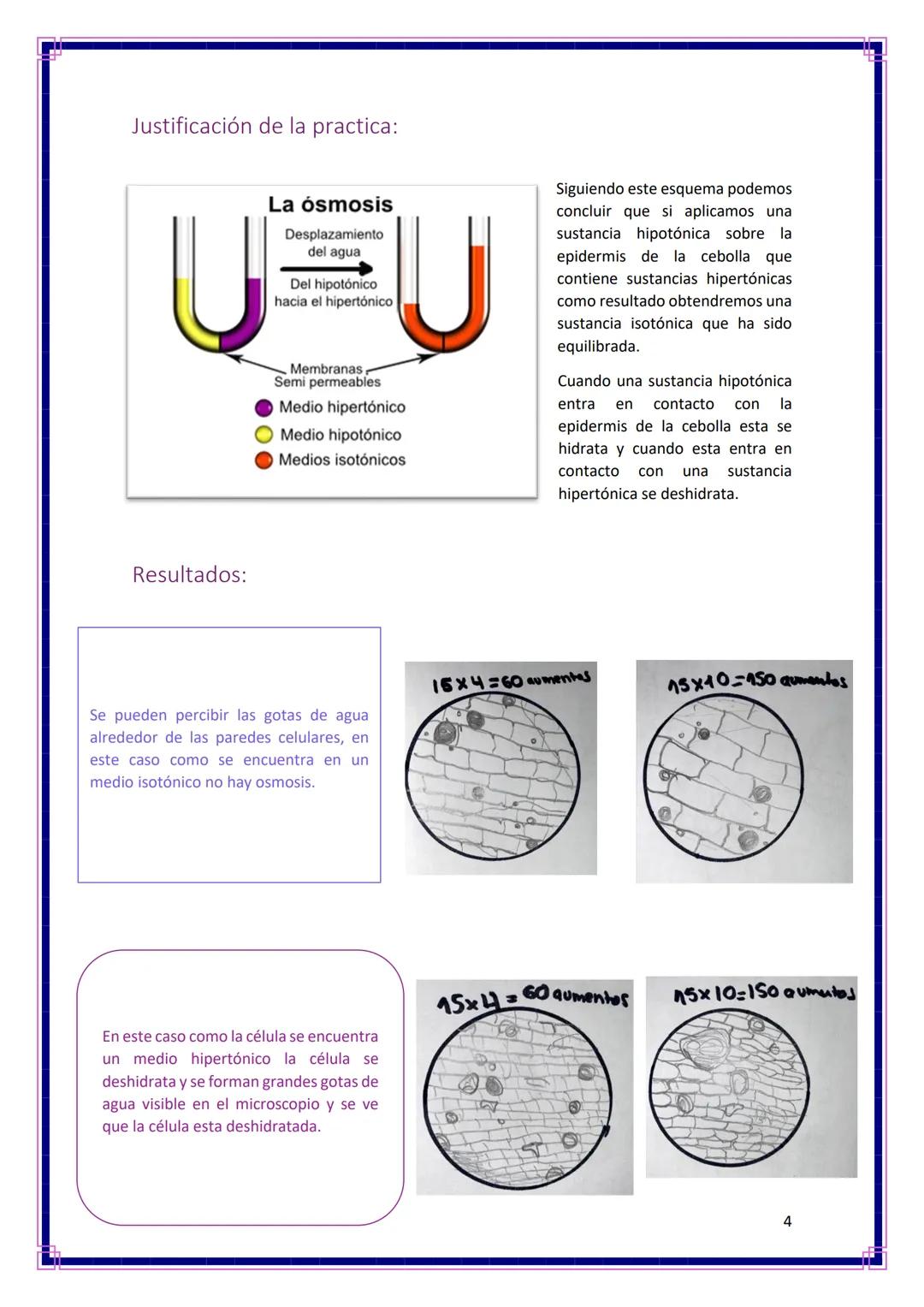 Ampliación de biología
OBJETIVOS:
●
Ósmosis
Informe Nº2
Observar los efectos producidos por la ósmosis en la epidermis de la cebolla.
Visual
