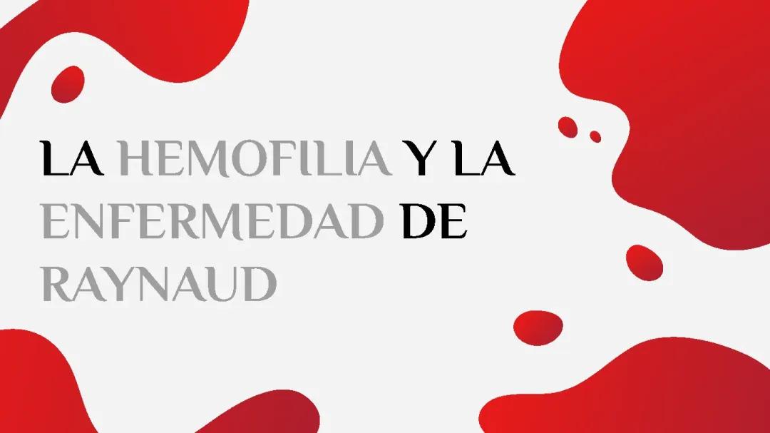 La hemofilia y la enfermedad de Raynaud