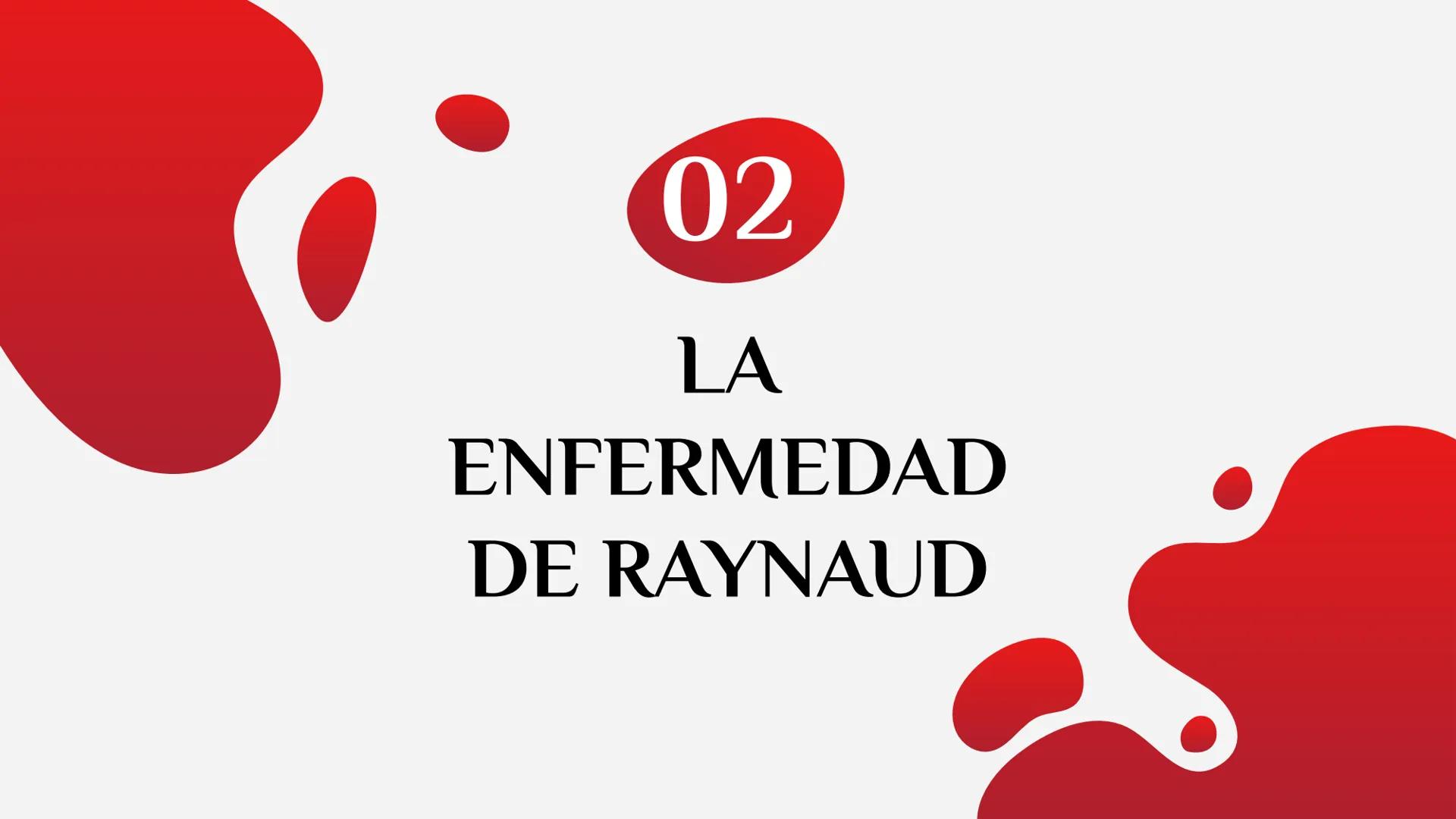 LA HEMOFILIA
ENFERMEDAD DE
RAYNAUD
Y LA ÍNDICE
01
Hemofilia
02
Enfermedad de
Raynaud 01
LA HEMOFILIA oooooo,
¿QUÉ ES?
CAUSAS
TIPOS
FACTORES 