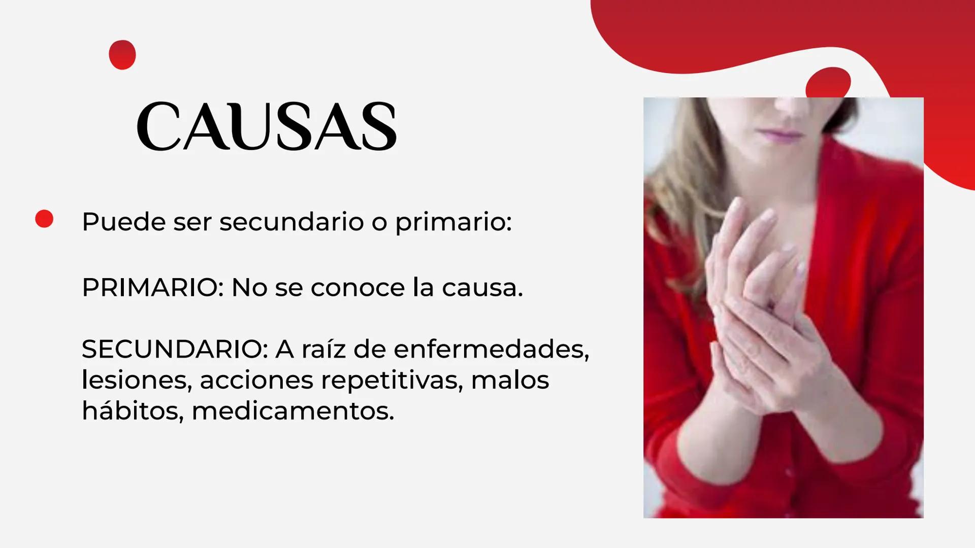 LA HEMOFILIA
ENFERMEDAD DE
RAYNAUD
Y LA ÍNDICE
01
Hemofilia
02
Enfermedad de
Raynaud 01
LA HEMOFILIA oooooo,
¿QUÉ ES?
CAUSAS
TIPOS
FACTORES 