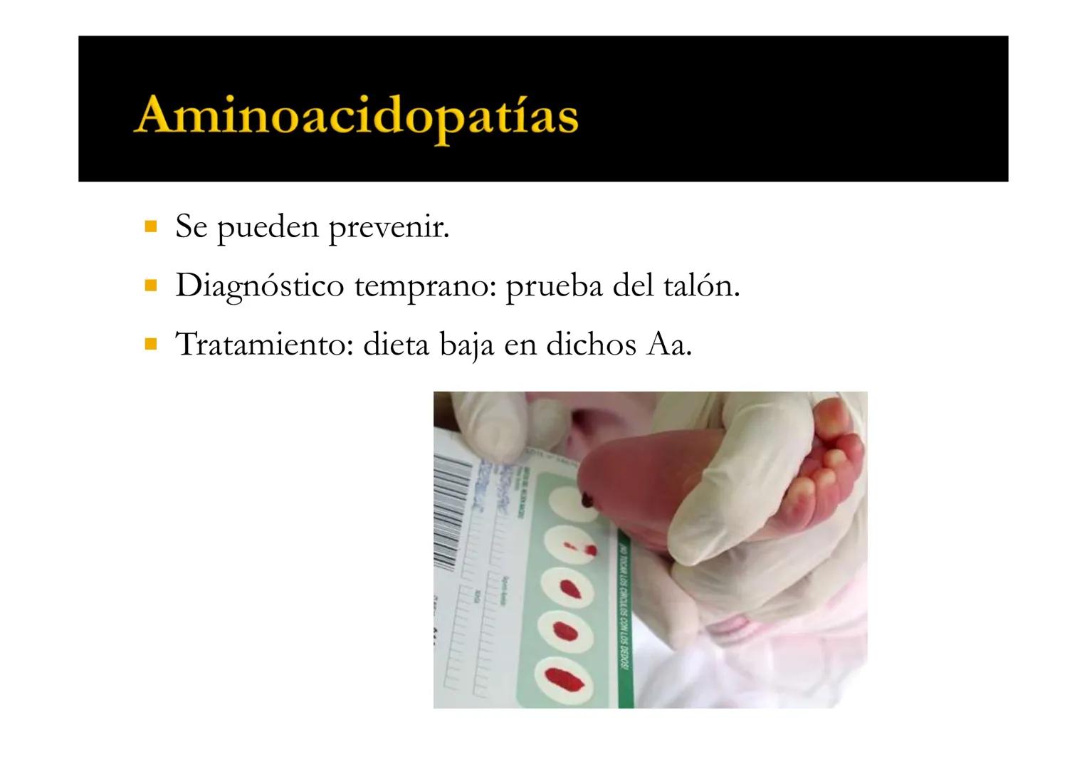 SUI
T4 AMINOÁCIDOS
Forman las proteínas
Bioquímica-I
Grado en Medicina
UNIVERSIDAD
ALFONSO X EL SABIO
Profs. Ana Martínez García
Isabel Olaz
