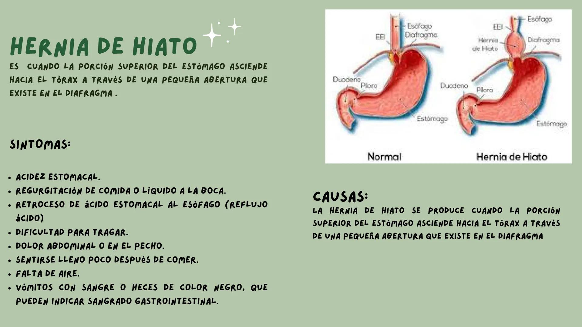 # PATOLOGIAS DEL
## APARATO
### GASTROINTESTINAL

EMILY & VALERIA INDICE

• PATOLOGIAS DE LA BOCA
1. PIORREA
2. ESTOMATITIS
• ENFERMEDADES E