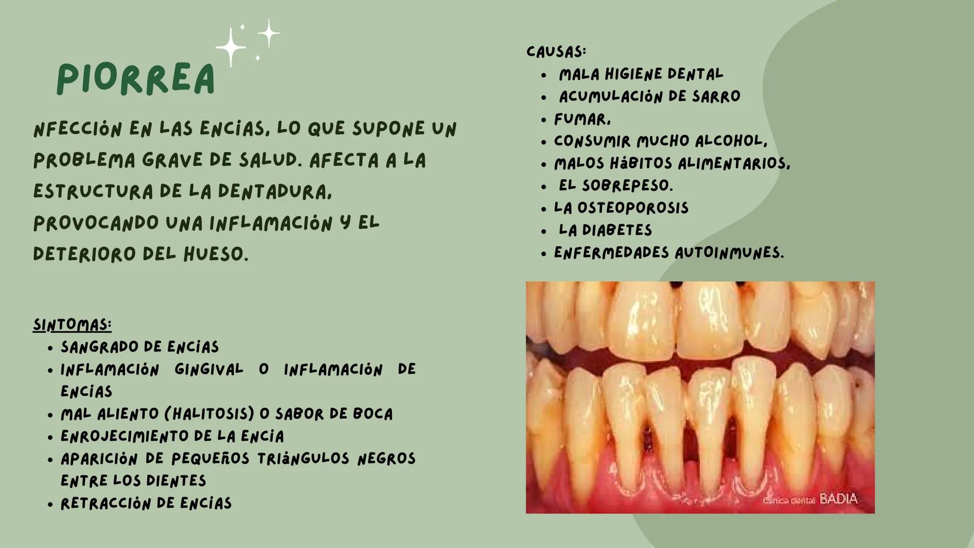 # PATOLOGIAS DEL
## APARATO
### GASTROINTESTINAL

EMILY & VALERIA INDICE

• PATOLOGIAS DE LA BOCA
1. PIORREA
2. ESTOMATITIS
• ENFERMEDADES E