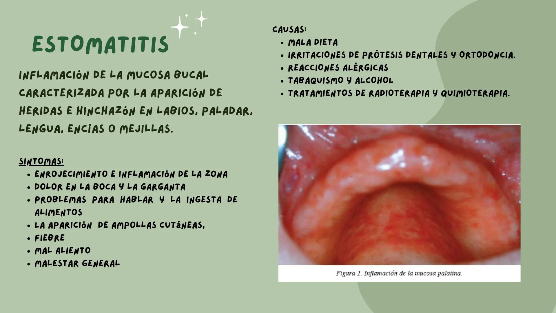# PATOLOGIAS DEL
## APARATO
### GASTROINTESTINAL

EMILY & VALERIA INDICE

• PATOLOGIAS DE LA BOCA
1. PIORREA
2. ESTOMATITIS
• ENFERMEDADES E