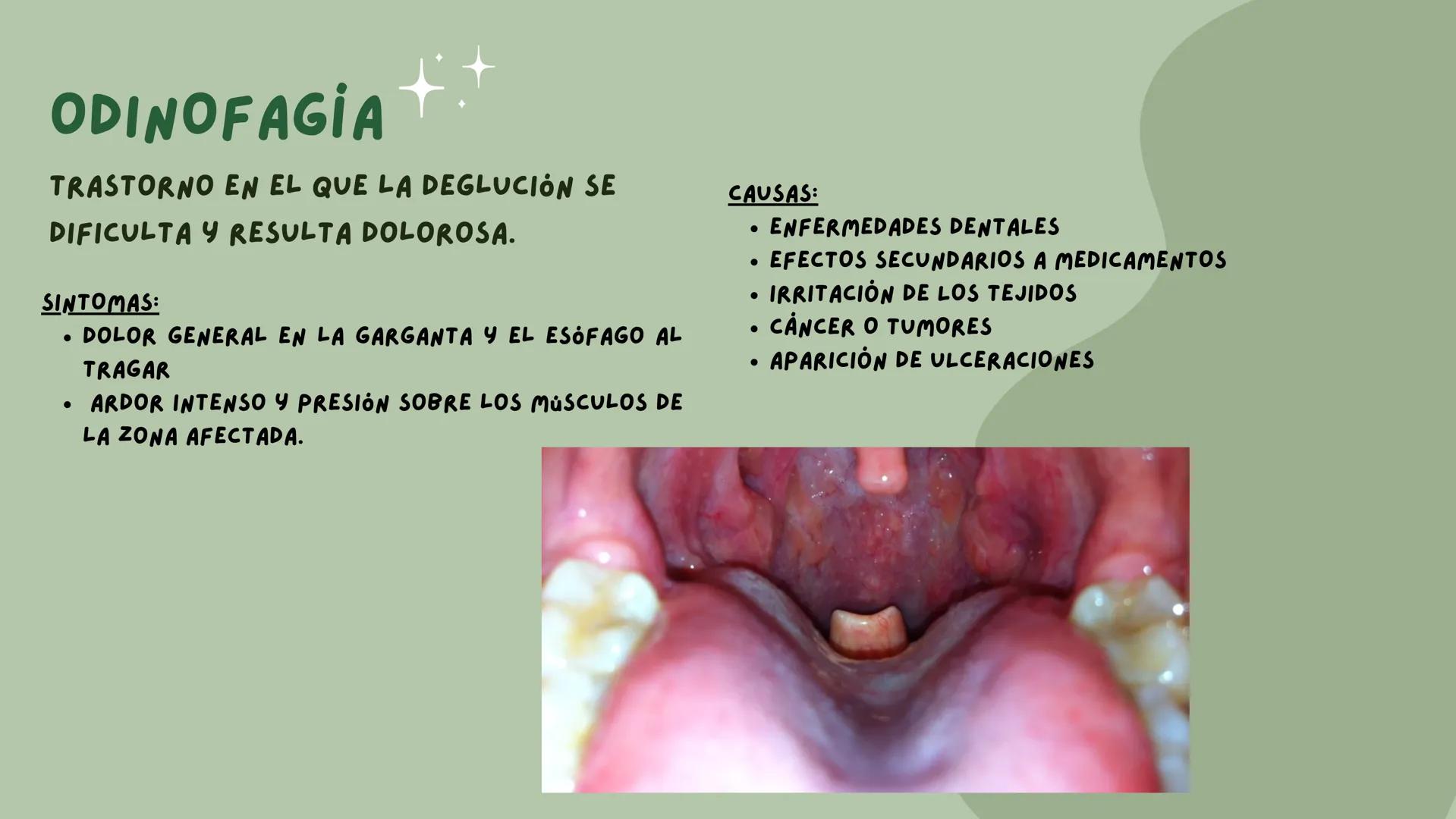 # PATOLOGIAS DEL
## APARATO
### GASTROINTESTINAL

EMILY & VALERIA INDICE

• PATOLOGIAS DE LA BOCA
1. PIORREA
2. ESTOMATITIS
• ENFERMEDADES E