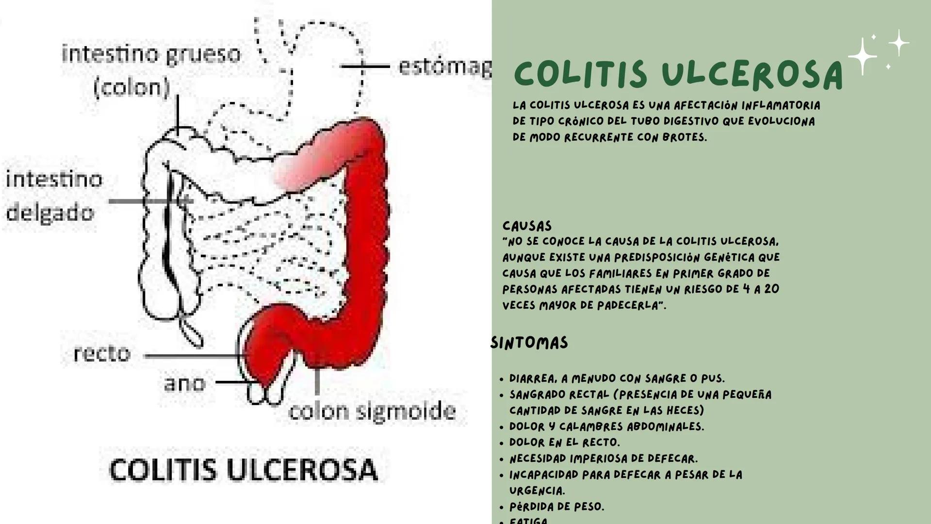# PATOLOGIAS DEL
## APARATO
### GASTROINTESTINAL

EMILY & VALERIA INDICE

• PATOLOGIAS DE LA BOCA
1. PIORREA
2. ESTOMATITIS
• ENFERMEDADES E