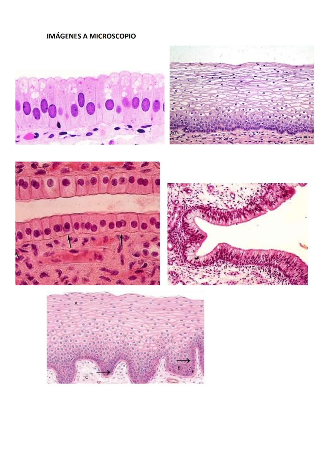 # TEJIDO EPITELIAL

EPITELIAL DE REVESTIMIENTO

Recubren las superficies expuestas al exterior, las cavidades internas o vías de paso.
Tiene