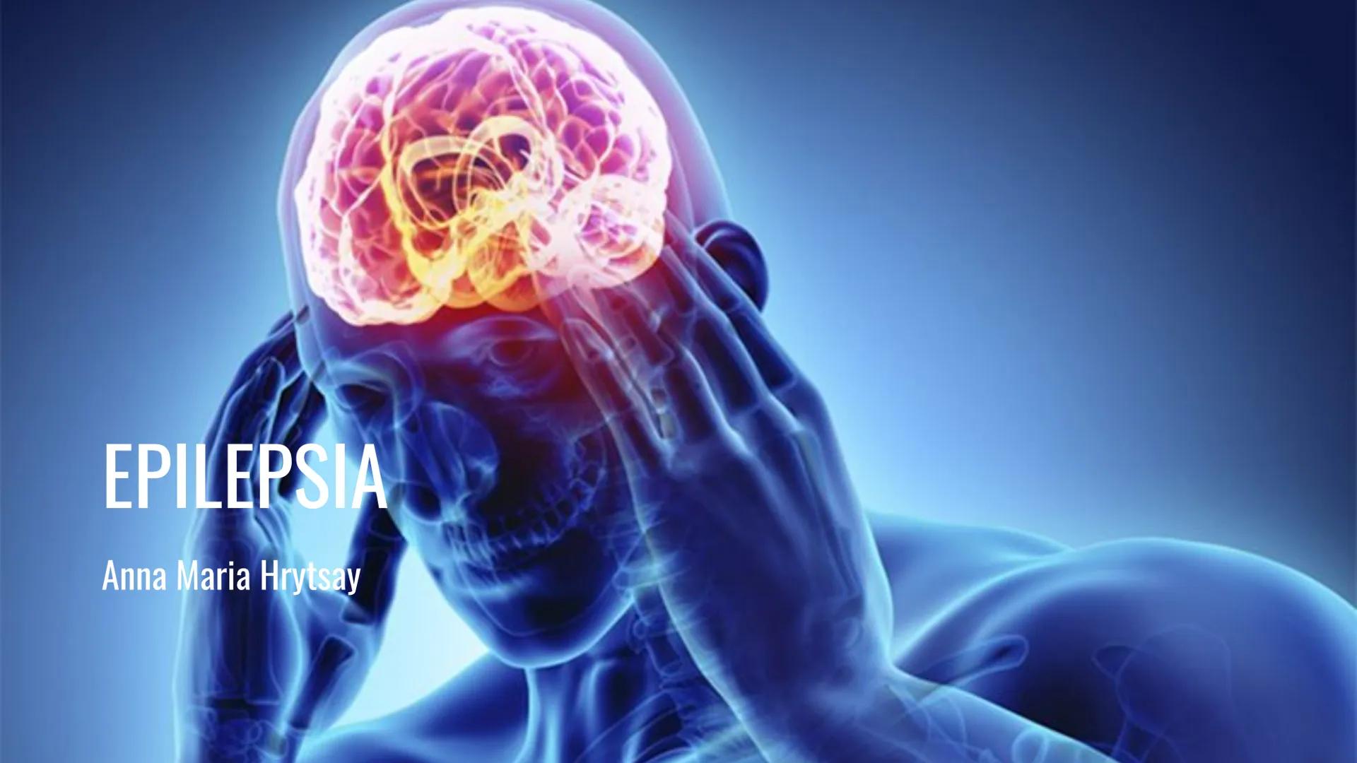 EPILEPSIA
Anna Maria Hrytsay Índice
•
Qué es la epilepsia
Síntomas
• Posibles causas
Población afectada
Diagnóstico
Tratamiento
Medidas de p