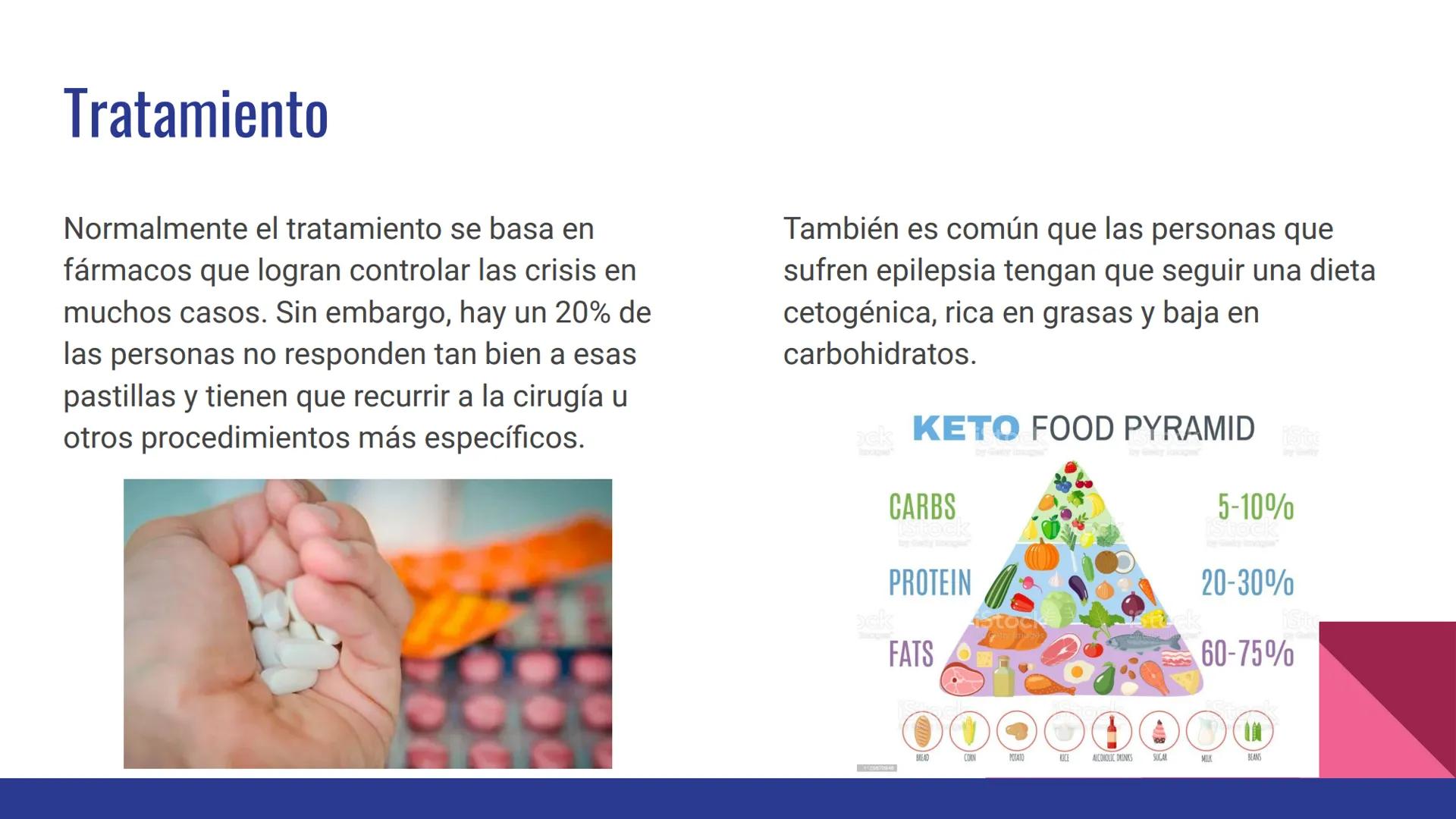 EPILEPSIA
Anna Maria Hrytsay Índice
•
Qué es la epilepsia
Síntomas
• Posibles causas
Población afectada
Diagnóstico
Tratamiento
Medidas de p