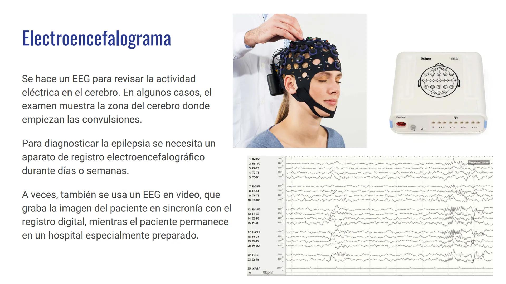 EPILEPSIA
Anna Maria Hrytsay Índice
•
Qué es la epilepsia
Síntomas
• Posibles causas
Población afectada
Diagnóstico
Tratamiento
Medidas de p
