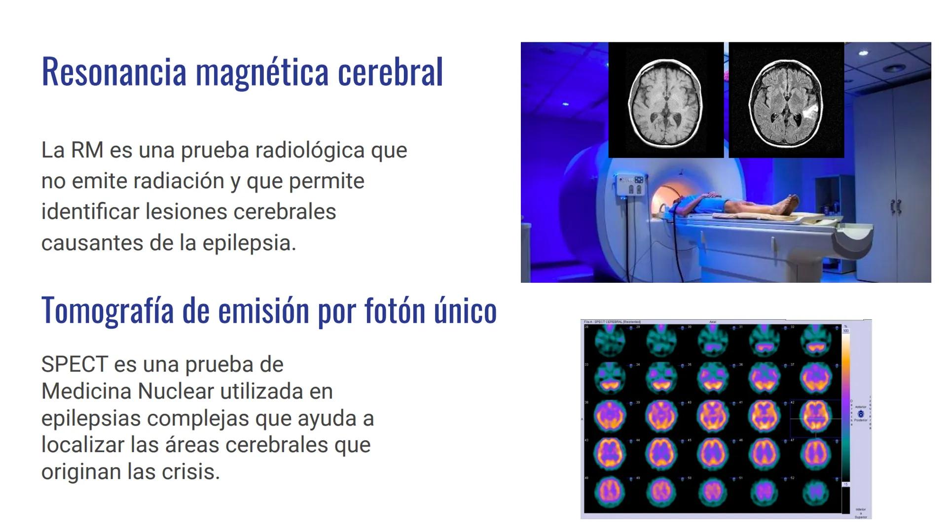 EPILEPSIA
Anna Maria Hrytsay Índice
•
Qué es la epilepsia
Síntomas
• Posibles causas
Población afectada
Diagnóstico
Tratamiento
Medidas de p