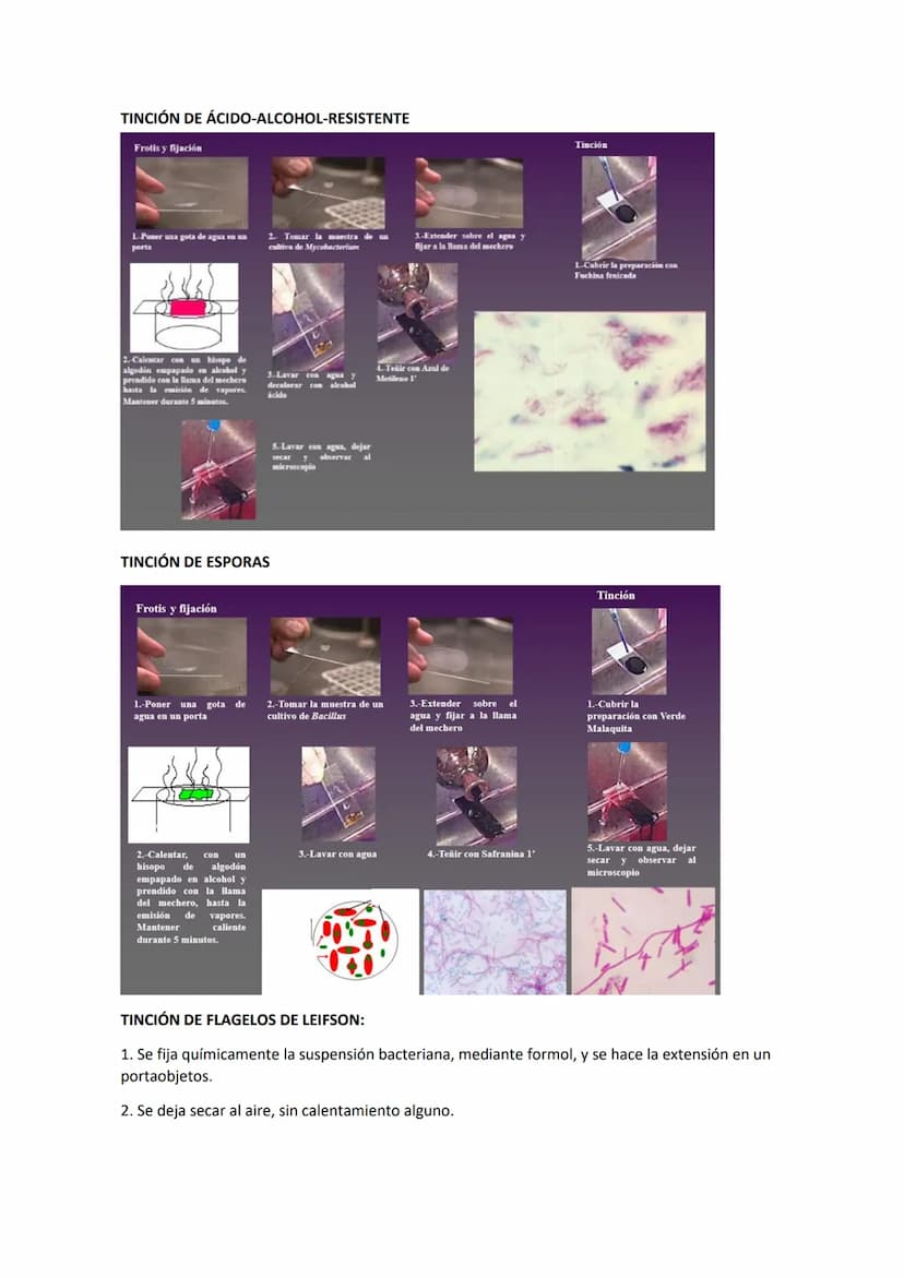 Tema 3 OBSERVACIÓN MICROSCÓPICA
CONTENIDOS
- El microscopio
- Técnicas para la observación microscópica
- Tipos de tinciones
Principios de ó