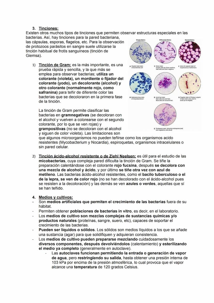MICROBIOLOGÍA
TEMA 11.1: INTRODUCCIÓN A LA MICROBIOLOGÍA
1. Introducción a la microbiología.
Microbiología: Ciencia que se encarga del estud