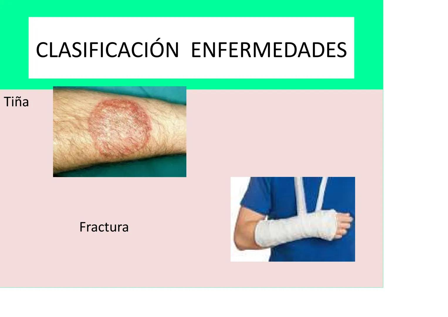 # LA SALUD Y EL SISTEMA
# INMUNITARIO # LA SALUD Y LA ENFERMEDAD
La definición DE SALUD de la OMS (Organización mundial de la Salud):
EST