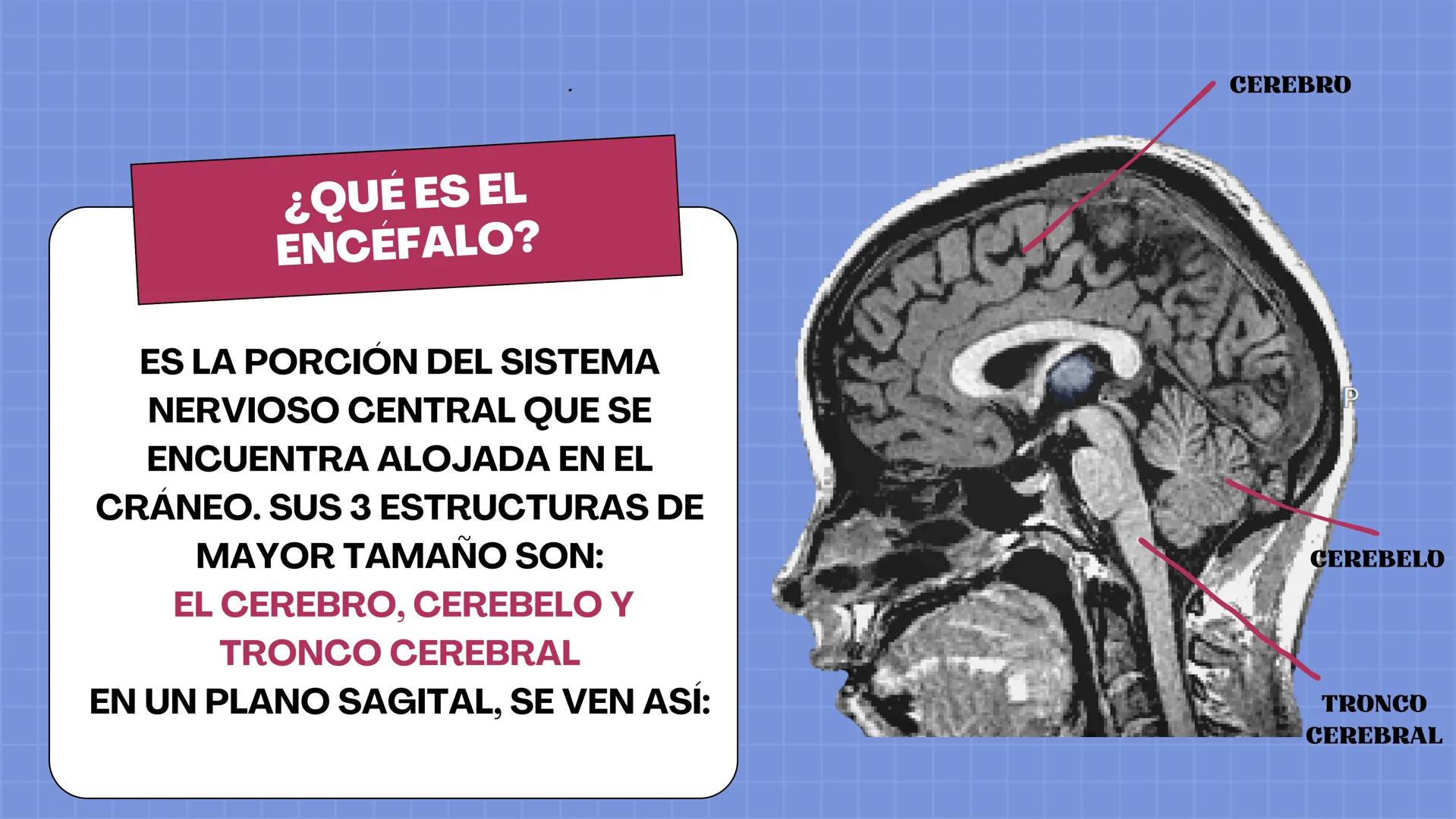 # LAURA V. CARRILLO
# EL ENCÉFALO EN 3 DIMENSIONES CEREBRO
¿QUÉ ES EL
ENCÉFALO?
ES LA PORCIÓN DEL SISTEMA
NERVIOSO CENTRAL QUE SE
ENCUENT