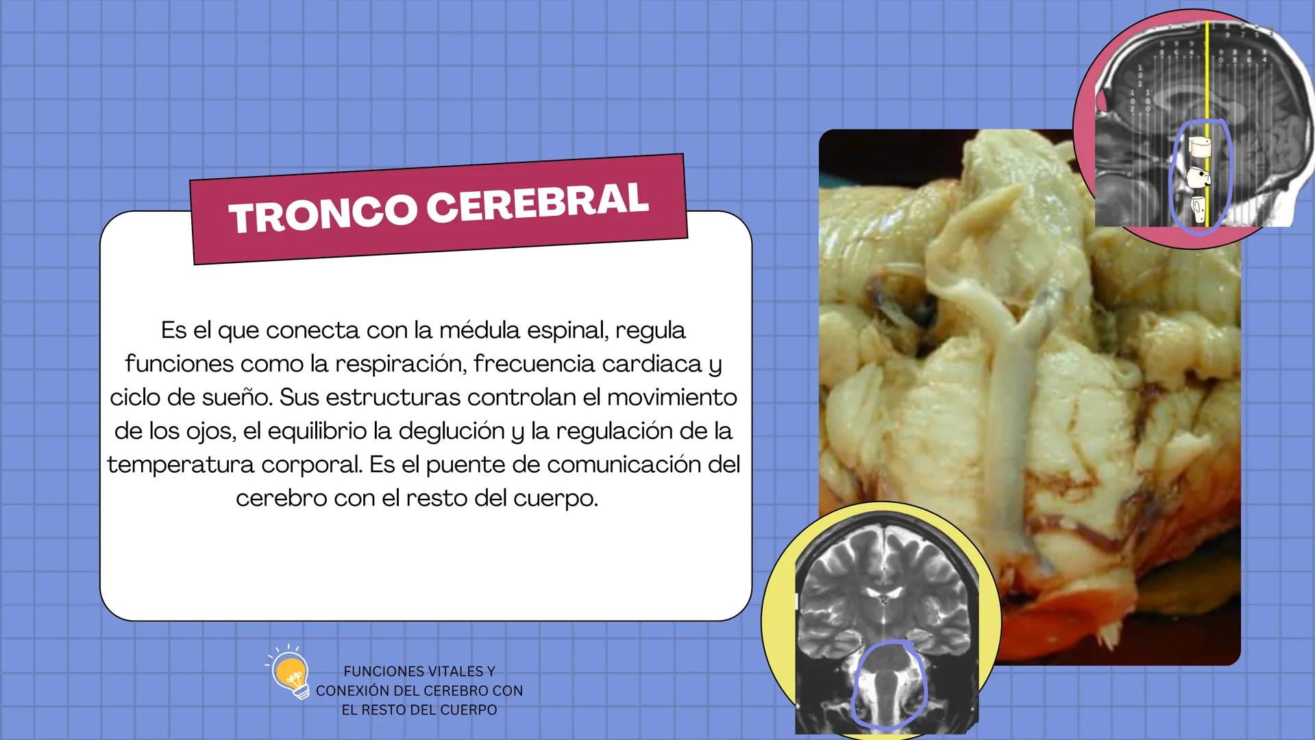# LAURA V. CARRILLO
# EL ENCÉFALO EN 3 DIMENSIONES CEREBRO
¿QUÉ ES EL
ENCÉFALO?
ES LA PORCIÓN DEL SISTEMA
NERVIOSO CENTRAL QUE SE
ENCUENT
