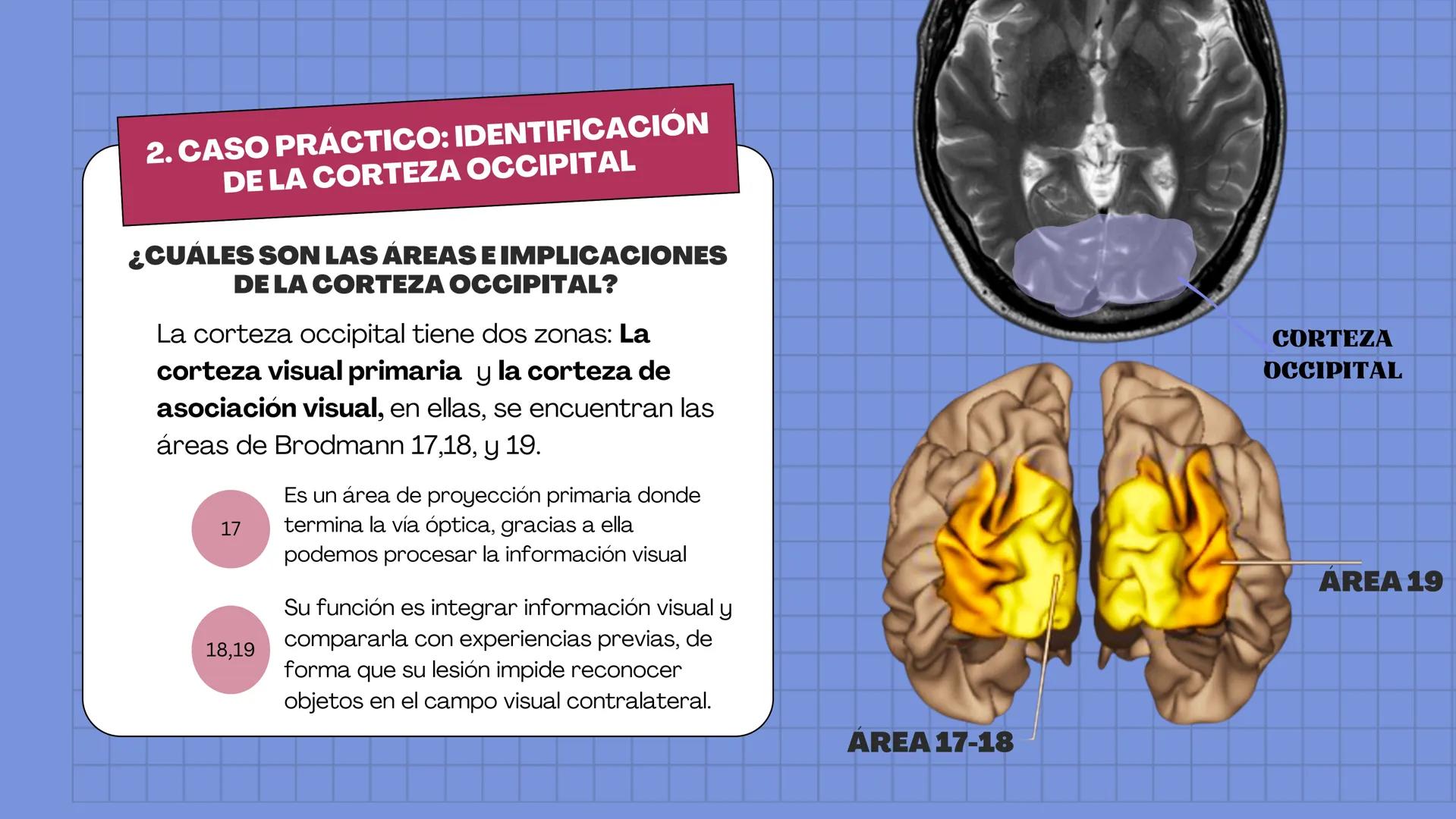 # LAURA V. CARRILLO
# EL ENCÉFALO EN 3 DIMENSIONES CEREBRO
¿QUÉ ES EL
ENCÉFALO?
ES LA PORCIÓN DEL SISTEMA
NERVIOSO CENTRAL QUE SE
ENCUENT
