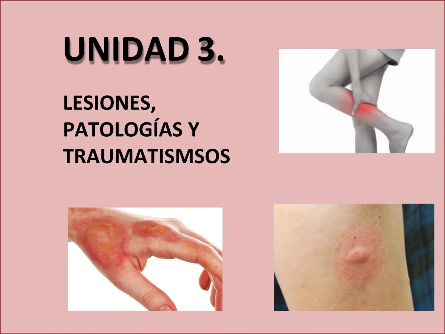 # UNIDAD 3.
LESIONES,
PATOLOGÍAS Y
TRAUMATISMOSOS UNIDAD 3.
Esquema de la unidad.
AGENTES FÍSICOS QUE CAUSAN ACCIDENTES
Mecánicos
1. He